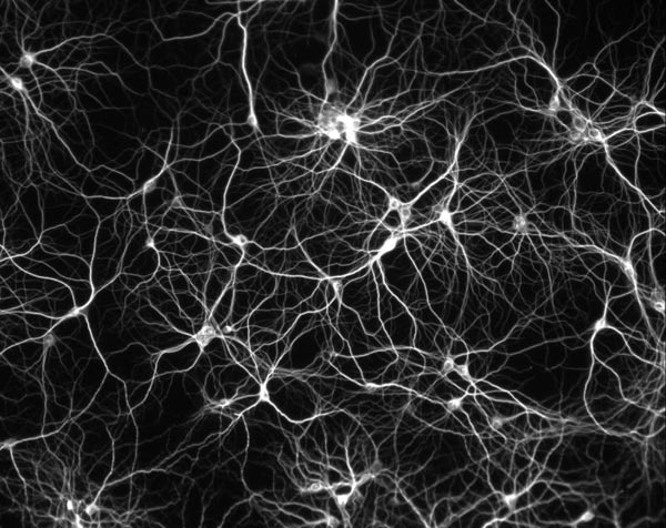 human brain neurons