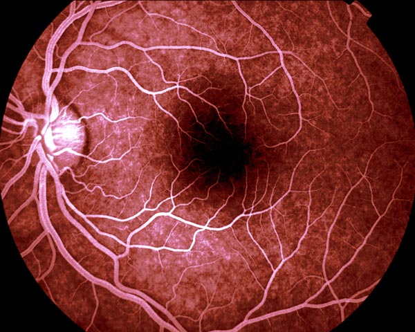 What are tiny blood vessels called?